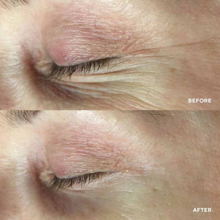 Гідрогелеві маски для зони навколо очей HydroPeptide PolyPeptide Collagel Eye Line-Lifting Hydrogel Masks