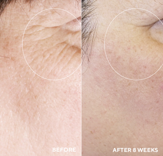 Набір для зволоження шкіри HydroPeptide Advanced Hydration Kit