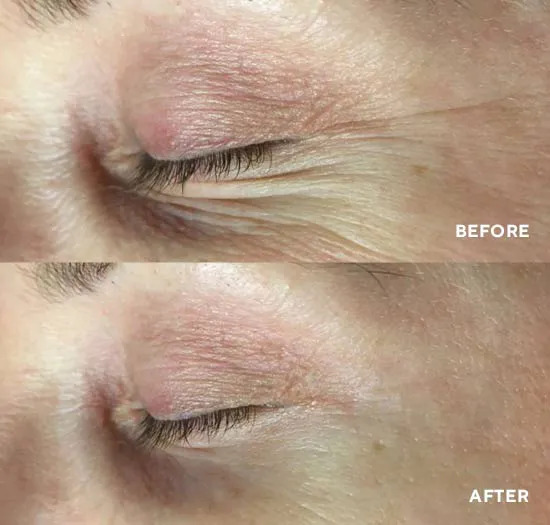 Набір для чоловіків HydroPeptide Men's Age Defense Kit