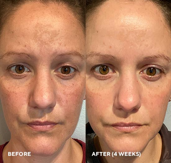 Зміцнювальний 20% концентрат вітаміну С HydroPeptide Firma-Bright 20% Vitamin C Booster