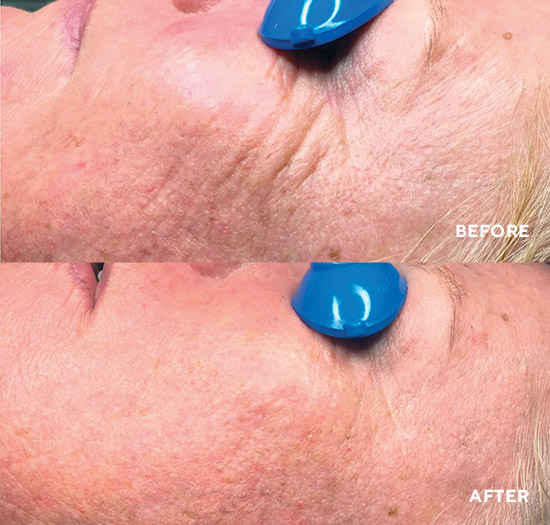 Нічний крем-бустер із комплексом підтримки колагену HydroPeptide Nimni Face Cream