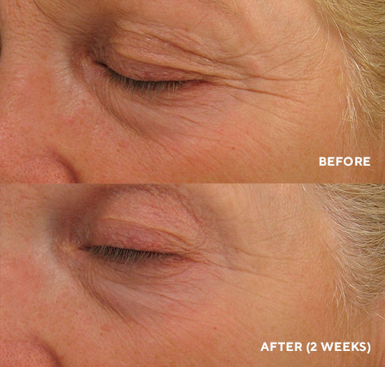  Інтенсивний ліфтинг-крем для повік HydroPeptide Eye Authority