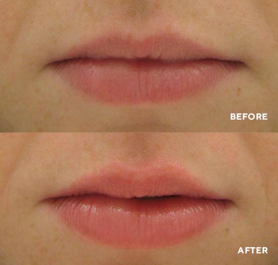 Живильний блиск для збільшення об'єму губ HydroPeptide Perfecting Gloss "Beach Blush"