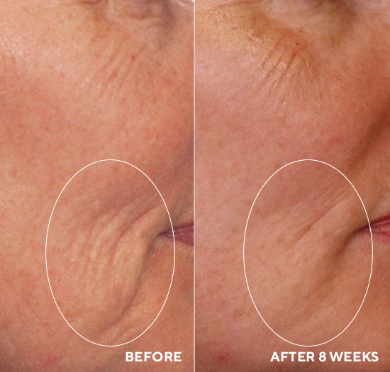 Пептидний бустер з гіалуроновою кислотою HydroPeptide Daily Drench